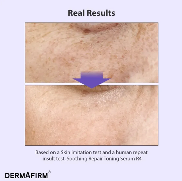 Мультифункціональна сироватка з бакучіолом - Soothing Repair Toning Serum R4 00-00000667 фото